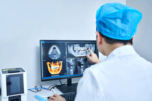 Best Knocked-Out Tooth (Avulsed Tooth) Treatment in Delta, OH