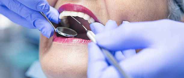 Best Emergency Denture Repair in Delta, OH