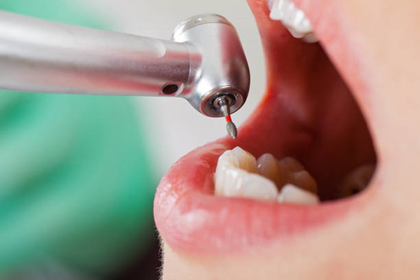 Best Urgent Dental Care for Toothaches in Delta, OH